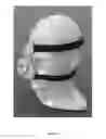 Fig. 06 - Obstructive Sleep Apnea Treatment Device