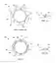Fig. 02 - Swaged braided catheter and method of fabrication