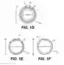 Fig. 03 - Compression resistant hose
