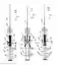 Fig. 11 - Needle for bloodless IV