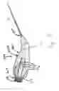Fig. 36 - Needle for bloodless IV