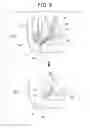 Fig. 09 - Method for inserting endoscopic device into hollow organ using guide wire