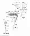 Fig. 04 - Devices and Methods for Dilating a Paranasal Sinus Opening and for Treating Sinusitis