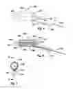 Fig. 05 - Devices and Methods for Dilating a Paranasal Sinus Opening and for Treating Sinusitis