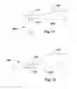 Fig. 07 - Devices and Methods for Dilating a Paranasal Sinus Opening and for Treating Sinusitis