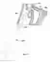 Fig. 10 - Devices and Methods for Dilating a Paranasal Sinus Opening and for Treating Sinusitis