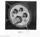 Fig. 03 - Medical leads