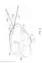 Fig. 06 - Implantable medical devices and methods for making and delivering implantable medical devices