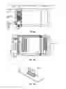 Fig. 09 - Implantable lead affixation structure for nerve stimulation to alleviate bladder dysfunction and other indication