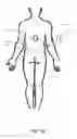 Fig. 07 - Transcutaneous neuromodulation system and methods of using same