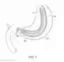 Fig. 03 - Conditional gastrointestinal stimulation for improved motility