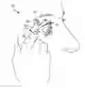 Fig. 01 - Stimulation devices and methods for treating dry eye
