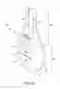 Fig. 05 - Stimulation devices and methods for treating dry eye