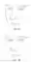 Fig. 17 - Stimulation devices and methods for treating dry eye