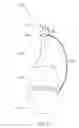 Fig. 36 - Stimulation devices and methods for treating dry eye