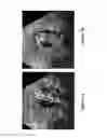 Fig. 04 - Systems and methods for real-time tracking of a target tissue using imaging before and during therapy delivery