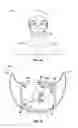 Fig. 02 - Air filtering devices and methods