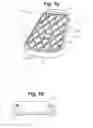 Fig. 02 - Climbing device with anchoring surface