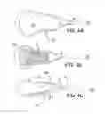 Fig. 05 - Sport exercise device