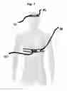 Fig. 02 - Sports Posture Training Aid