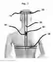 Fig. 03 - Sports Posture Training Aid