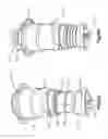 Fig. 11 - Flow control devices and related systems