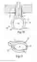Fig. 08 - Device and method for the manufacture or repair of a three-dimensional object