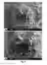 Fig. 09 - CMP PAD CONDITIONER AND METHOD FOR MANUFACTURING THE SAME