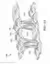 Fig. 09 - Pneumatic tire with a three dimensional component