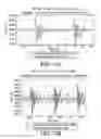Fig. 04 - Vehicle loading condition detection system and method