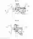 Fig. 11 - Vehicle body front part structure