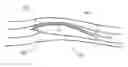 Fig. 01 - LOW DRAG TURBULENCE GENERATORS FOR AIRCRAFT WINGS