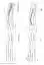 Fig. 03 - LOW DRAG TURBULENCE GENERATORS FOR AIRCRAFT WINGS