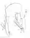 Fig. 06 - TAMPER RESISTANT CONTAINER