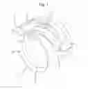 Fig. 02 - Hose clamp