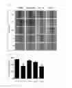 Fig. 02 - Pyridopyrimidinone compounds for modulating the catalytic activity of histone lysine demethylases (KDMs)