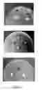 Fig. 09 - ANTIBACTERIAL POWDERS BASED ON ANIONIC SILICON OR TITANIUM DIOXIDE ADSORBED WITH PHARMACEUTICALLY ACTIVE CATIONS