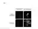 Fig. 04 - Method for producing antibody using “naked” expression vector expressing type II transmembrane fusion protein