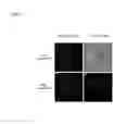 Fig. 05 - Method for producing antibody using “naked” expression vector expressing type II transmembrane fusion protein
