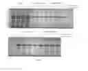 Fig. 06 - Method for extracting recombinant human serum albumin from transgenic rice grain
