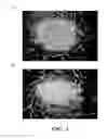 Fig. 03 - Cell separation and culture device