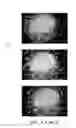 Fig. 04 - Cell separation and culture device