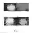 Fig. 06 - Cell separation and culture device