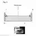 Fig. 04 - METHOD FOR SEPARATION OF SPORADIC CELLS FROM BODY FLUIDS, AND APPARATUS FOR CARRYING OUT SAID METHOD