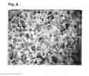 Fig. 05 - METHOD FOR SEPARATION OF SPORADIC CELLS FROM BODY FLUIDS, AND APPARATUS FOR CARRYING OUT SAID METHOD