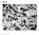 Fig. 06 - METHOD FOR SEPARATION OF SPORADIC CELLS FROM BODY FLUIDS, AND APPARATUS FOR CARRYING OUT SAID METHOD