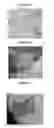 Fig. 02 - Small mobile stem cells (SMS) and uses thereof