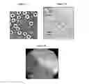 Fig. 04 - Small mobile stem cells (SMS) and uses thereof