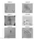 Fig. 05 - Small mobile stem cells (SMS) and uses thereof