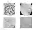 Fig. 11 - Small mobile stem cells (SMS) and uses thereof